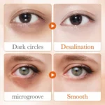 Before and after results using Sadoer 5X vitamin C eye cream for dark circles and puffiness