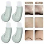 blackhead remover tool